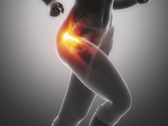 Hip Pain Physical Therapy Fort Myers Palm Pointe