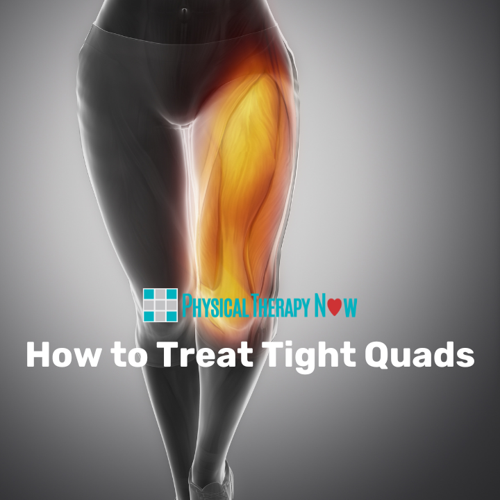 How to Treat Tight Quads
